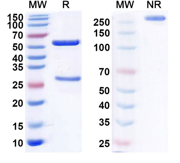 Human CD22 (ADCT-602) Antibody (ADC, Payload-Free) - SDS-PAGE