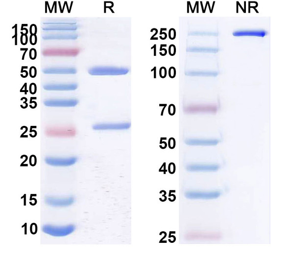 Human CD22 (JCAR018) Antibody - SDS-PAGE