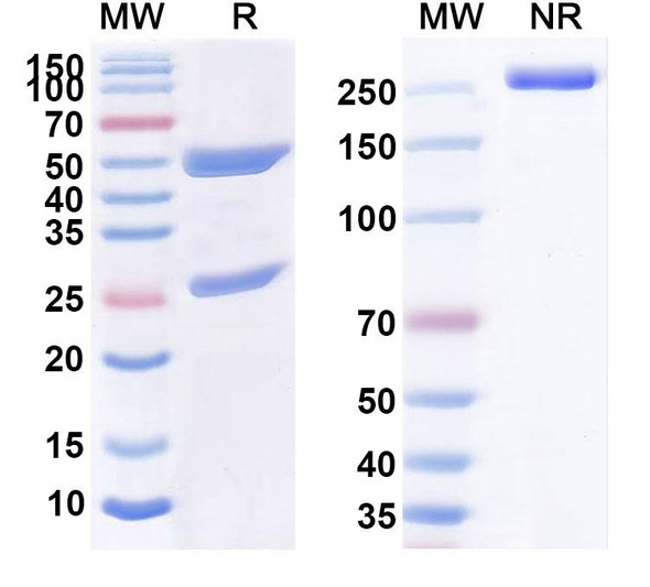 Human CD32b/FCGR2B (HuMax-CD32b) Antibody - SDS-PAGE
