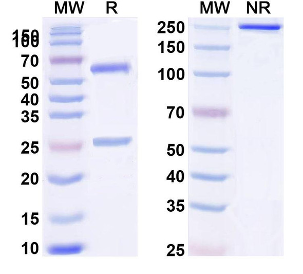 Human CD32b/FCGR2B (SM201) Antibody - SDS-PAGE