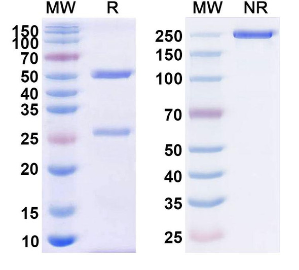 Human CD38/ADPRC 1 (CID-103) Antibody - SDS-PAGE