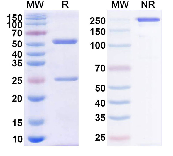 Human CD38/ADPRC 1 (CM313) Antibody - SDS-PAGE