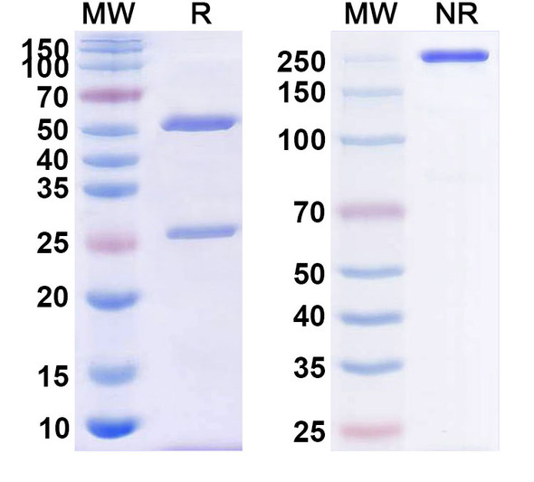 Human CD39/ENTPD1 (PUR001) Antibody - SDS-PAGE