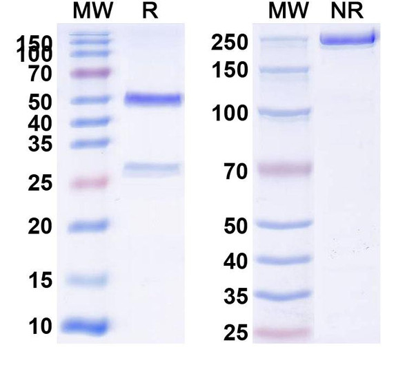 Human CD39/ENTPD1 (SRF617) Antibody - SDS-PAGE