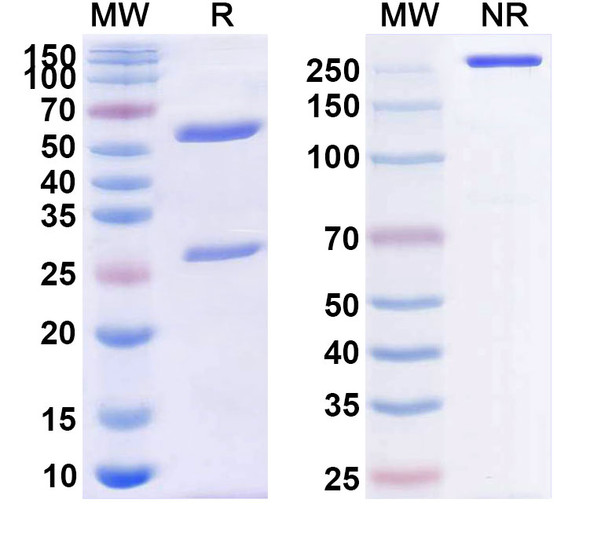 Human CD4 (TRX1) Antibody - SDS-PAGE