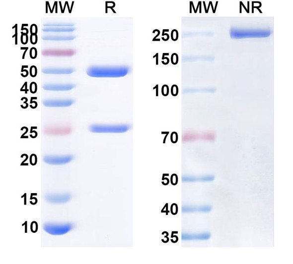 Human CD154/CD40LG/TNFSF5 (ABI793) Antibody - SDS-PAGE