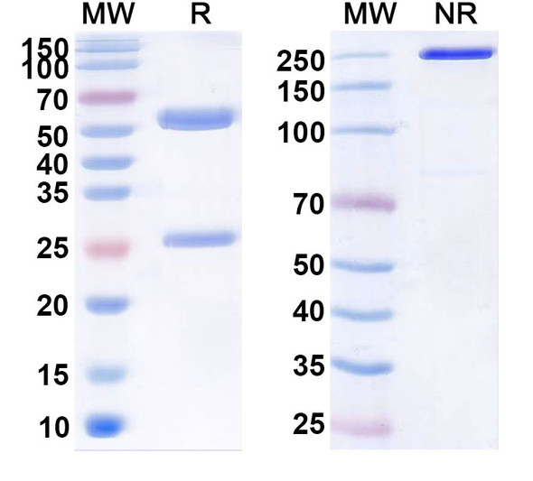 Human CLDN18.2 (RC118) Antibody (ADC, Payload-Free) - SDS-PAGE