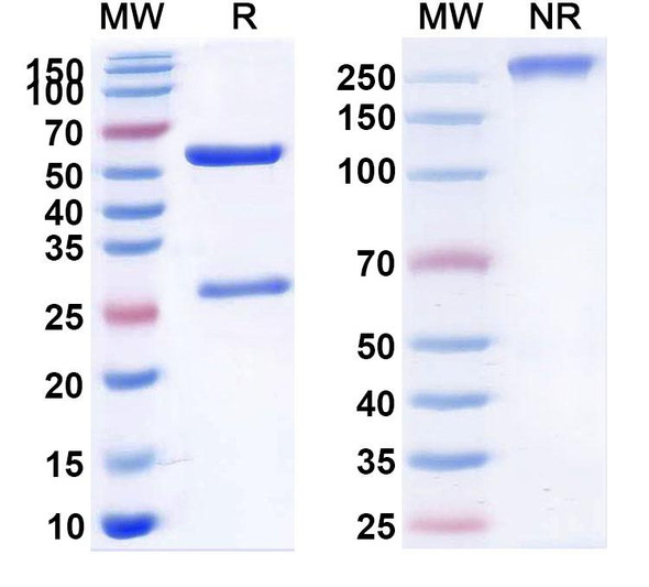 Human MET/c-Met/HGFR (hucMet27-DGN549) Antibody (ADC, Payload-Free) - SDS-PAGE