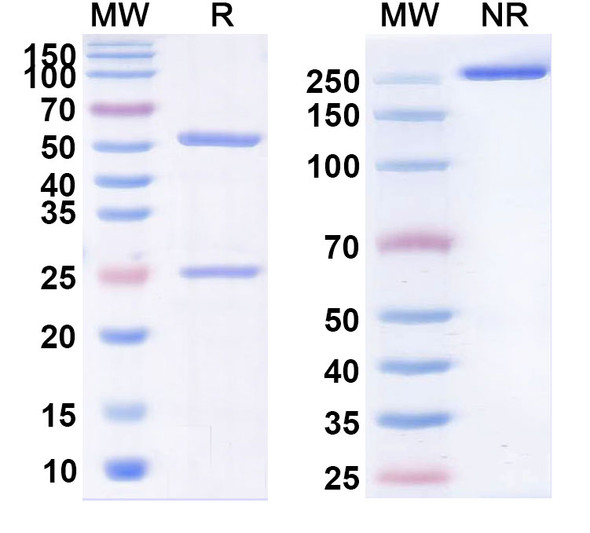 Human MET/c-Met/HGFR (STI-0607) Antibody - SDS-PAGE