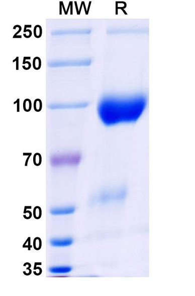 Belatacept (Research-Grade) - SDS-PAGE