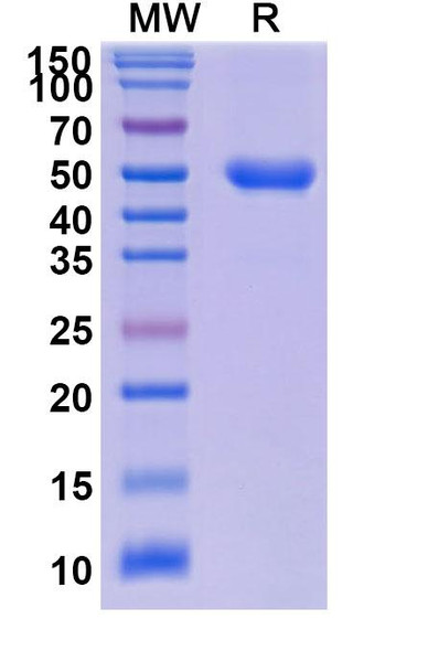 Dalantercept (Research-Grade) - SDS-PAGE