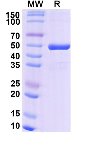 Efgivanermin Alfa (Research-Grade) - SDS-PAGE