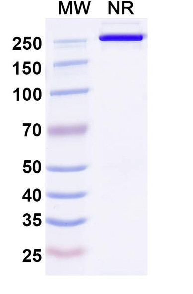 Human DLK1 (ADCT-701) Antibody (ADC, Payload-Free) - SDS-PAGE