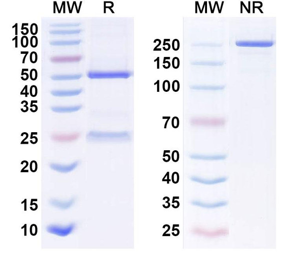 Human EGFR/ERBB1/HER1 (BB 1705) Antibody - SDS-PAGE