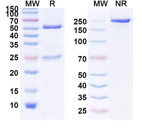 Human EGFR/ERBB1/HER1 (DXL1218) Antibody - SDS-PAGE