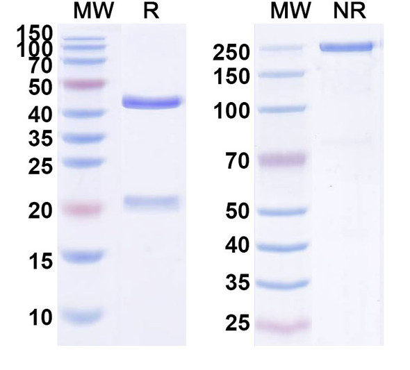 Human EGFR/ERBB1/HER1 (TAD011) Antibody - SDS-PAGE