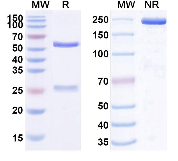 Human FPN1/SLC40A1/Ferroportin (LY2928057) Antibody - SDS-PAGE