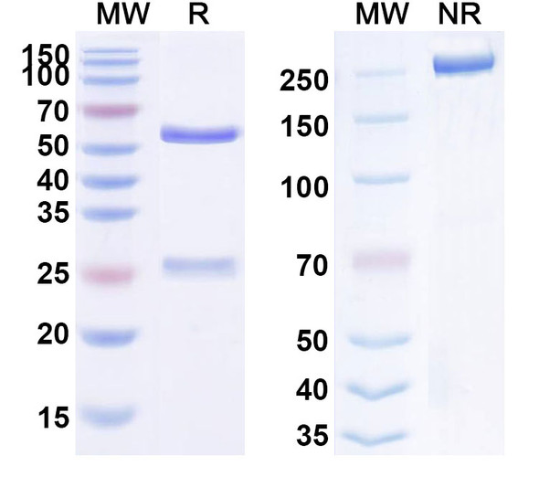 Human CD332/FGFR2 (GP369) Antibody - SDS-PAGE