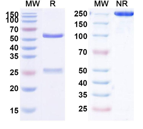 Human LGALS9 (HFB200901) Antibody - SDS-PAGE