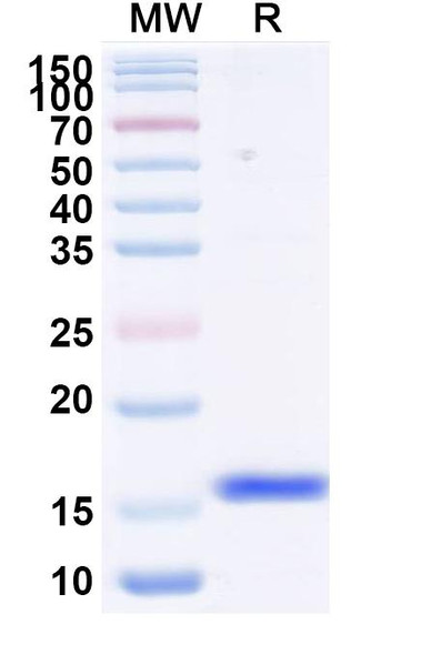 Anti-RSV F/Fusion glycoprotein F0 (F4) Antibody - SDS-PAGE
