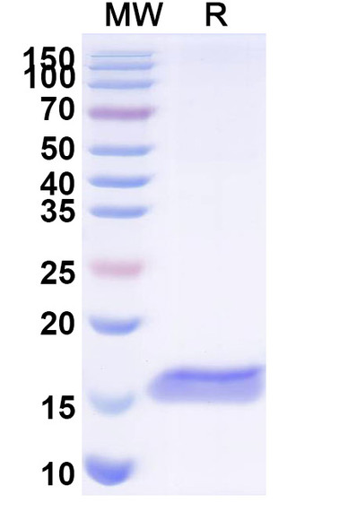Anti-RSV F/Fusion glycoprotein F0 (L66) Antibody - SDS-PAGE