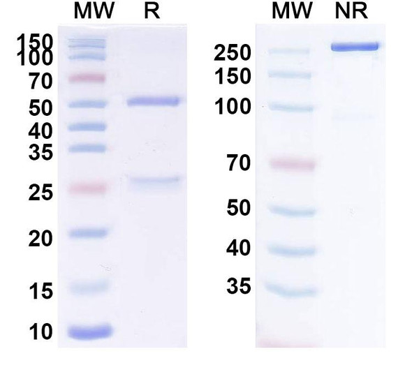 Anti-SARS-CoV-2 RBD (6M6) Antibody - SDS-PAGE
