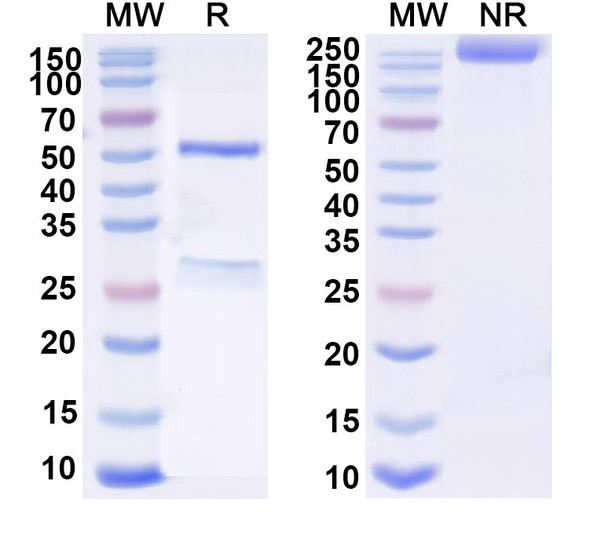 Anti-SARS-CoV-2 RBD (COV44-62) Antibody - SDS-PAGE