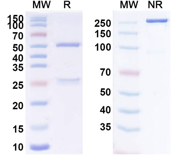 Anti-SARS-CoV-2 RBD (COV44-79) Antibody - SDS-PAGE