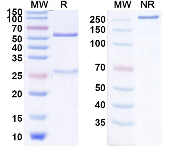 Anti-SARS-CoV-2 RBD (Beta-27 Fab) Antibody - SDS-PAGE