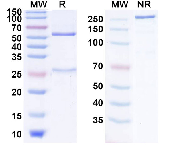 Anti-SARS-CoV-2 RBD (S304) Antibody - SDS-PAGE