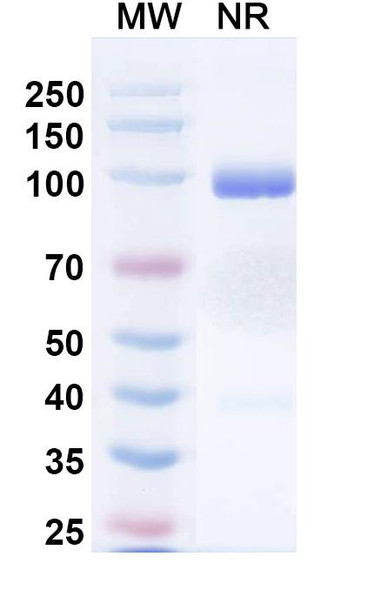 Porustobart Antibody - SDS-PAGE