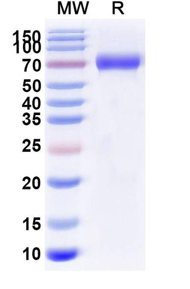 Albiglutide (Research-Grade) - SDS-PAGE