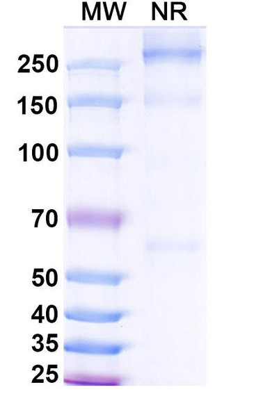 Asfotase alfa (Research-Grade) - SDS-PAGE