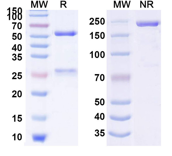Anti-SARS-CoV-2 NTD Protein (CV3-13) Antibody - SDS-PAGE