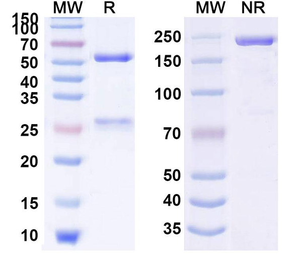 Anti-SARS-CoV-2 NTD Protein (CV3-13) Antibody - SDS-PAGE