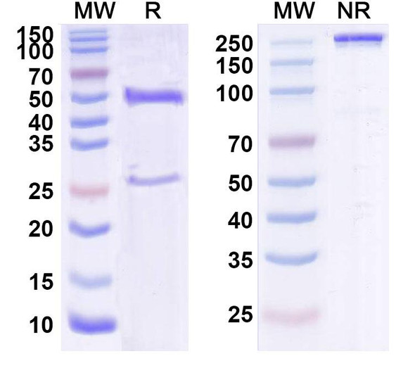 Human CD340/ERBB2/HER2/NEU (SC-007) Antibody - SDS-PAGE