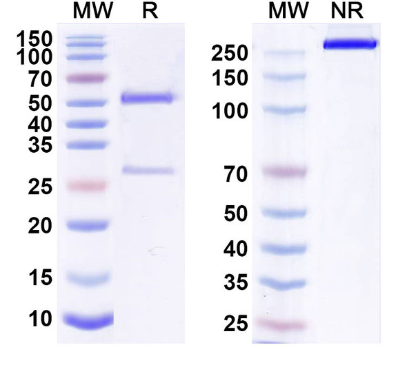 Human CD340/ERBB2/HER2/NEU (IGN001) Antibody - SDS-PAGE