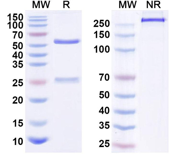 Human CD340/ERBB2/HER2/NEU (T1E28z) Antibody - SDS-PAGE