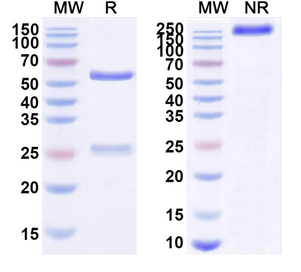 Human CD340/ERBB2/HER2/NEU (ZV0201) Antibody - SDS-PAGE