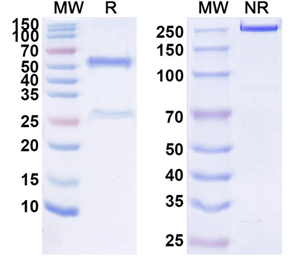 Human HLA-DR (IMMU-114) Antibody - SDS-PAGE