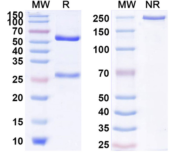 Human IL17RB (SM17) Antibody - SDS-PAGE