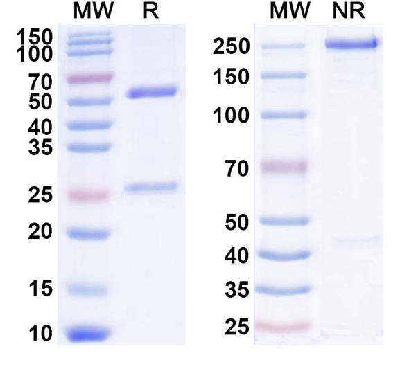 Human IL2 (AU 007) Antibody - SDS-PAGE