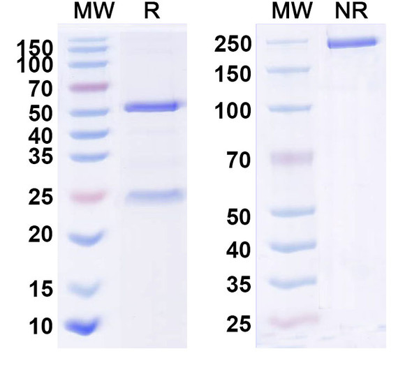 Human IL22RA1 (F 652) Antibody - SDS-PAGE