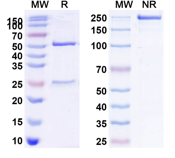 Human CD122/IL2RB (Mik beta 1) Antibody - SDS-PAGE