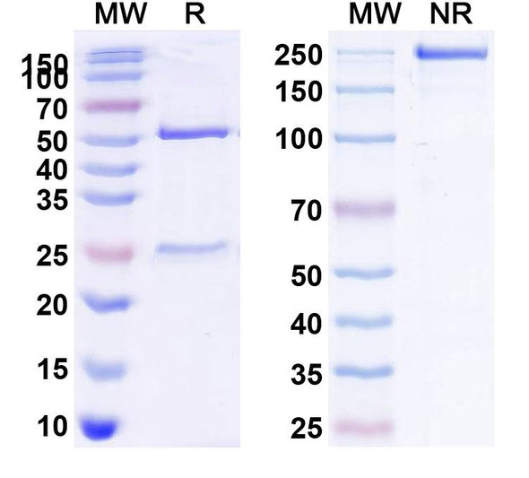 Human CD122/IL2RB (Mik beta 1) Antibody - SDS-PAGE