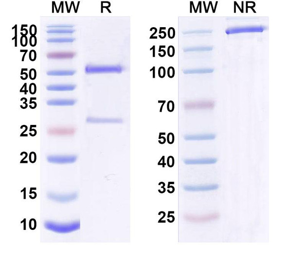 Human CD124/IL4R/IL-4Rα (BC 005) Antibody - SDS-PAGE