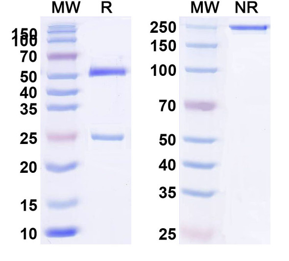 Human CD124/IL4R/IL-4Rα (MEDI2045) Antibody - SDS-PAGE