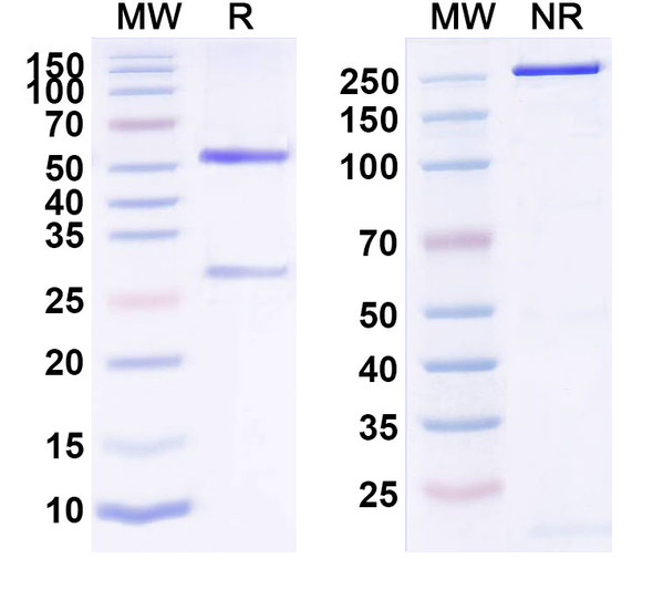 Human IL6 (FM101) Antibody - SDS-PAGE