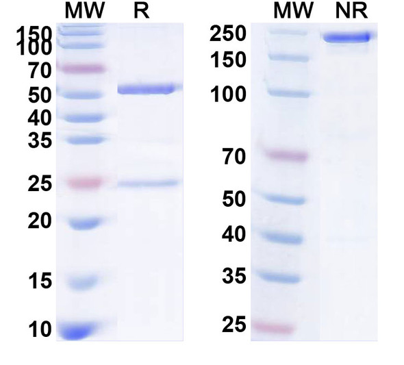 Human CD126/IL6R/IL-6RA (PM-1) Antibody - SDS-PAGE