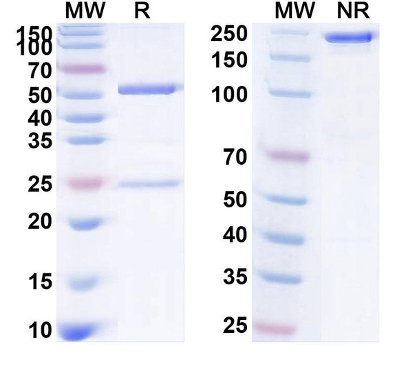 Human CD126/IL6R/IL-6RA (PM-1) Antibody - SDS-PAGE
